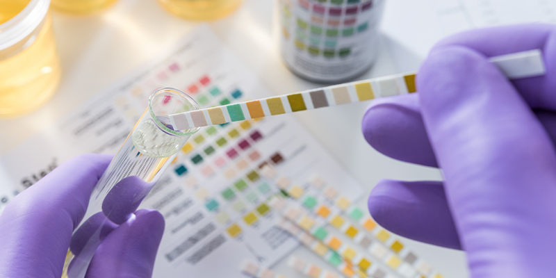 Is het gebruik van kratom zichtbaar op een drugstest?