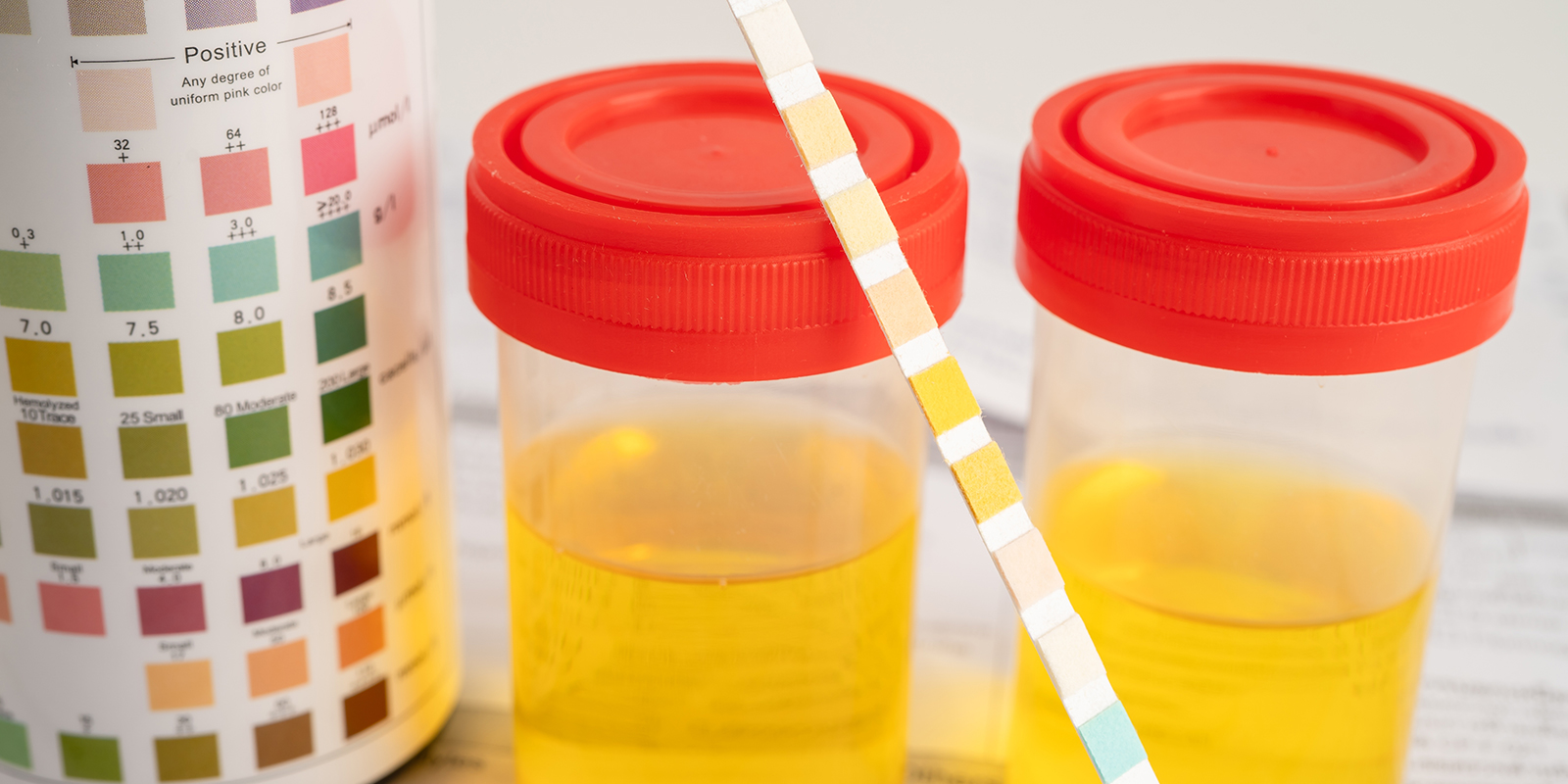 Detectievensters Detectievensters