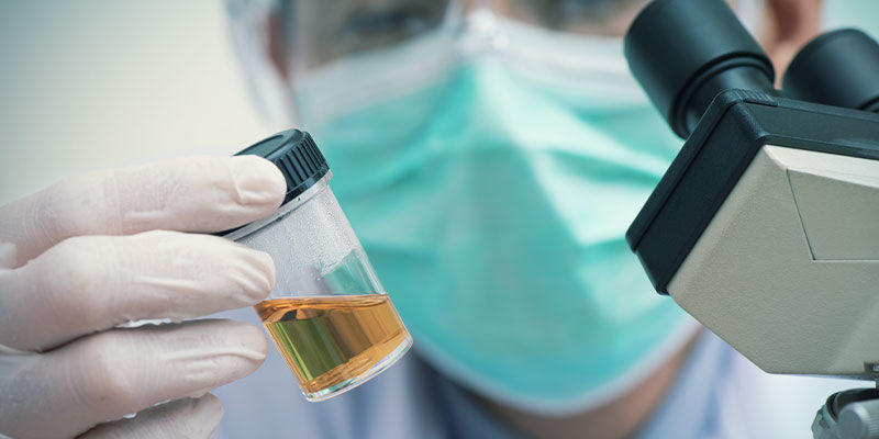 Voorbeelden Van Waar Een Laboratorium Je Urinemonster Op Test