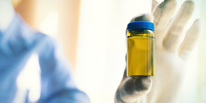 Wat Gebeurt Er Als Je Niet Voor Een Drugstest Slaagt?