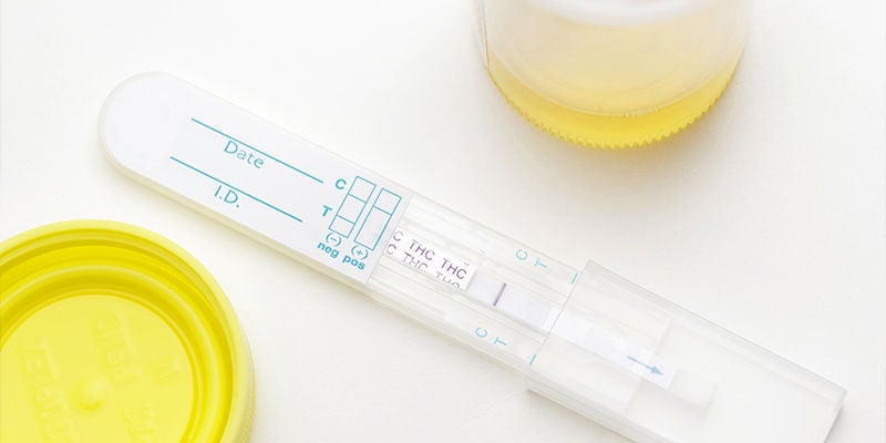 Hoe bereid ik me voor op een drugstest?