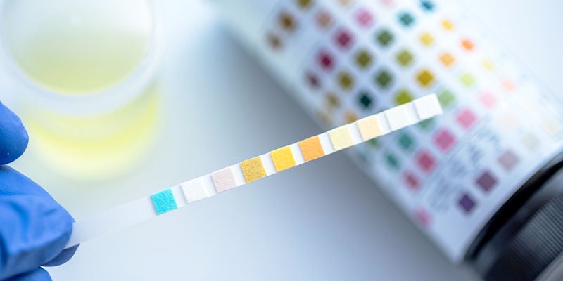 Hoe werkt een THC drugstest?