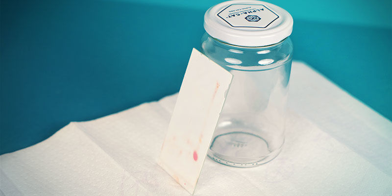 Alpha-Cat Mini Testkit: De testresultaten bekijken