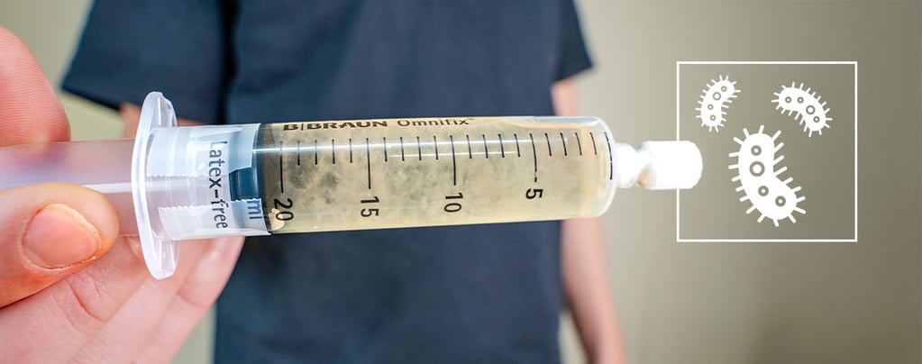 Wat is liquid culture? Een handleiding voor beginners
