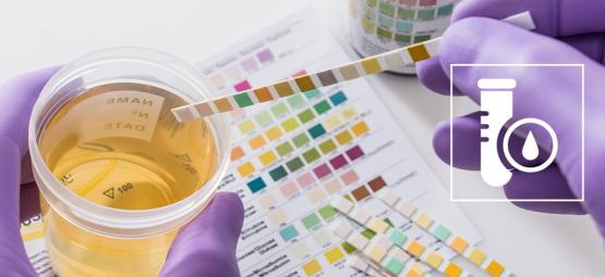 Hoe Slaag Je Voor Een THC Drugstest? (2025)